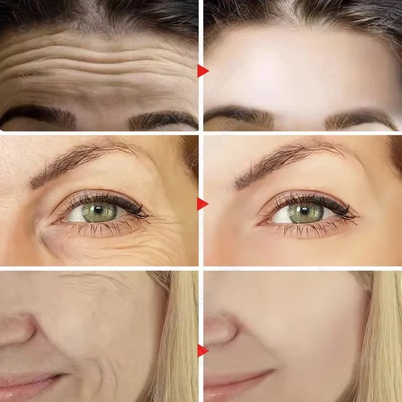 Anti-Wrinkle, Brightening and Intense Moisturizing